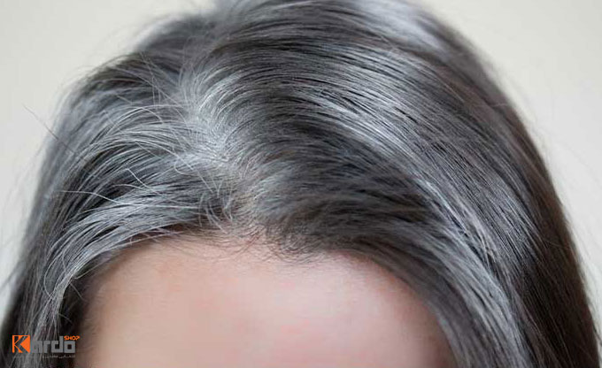 از بین بردن موهای سفید بدون دکلره