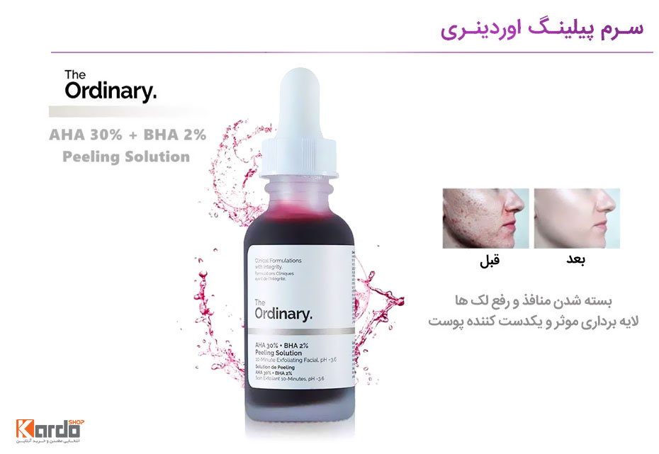 سرم لایه بردار پیلینگ سلوشن اوردینری