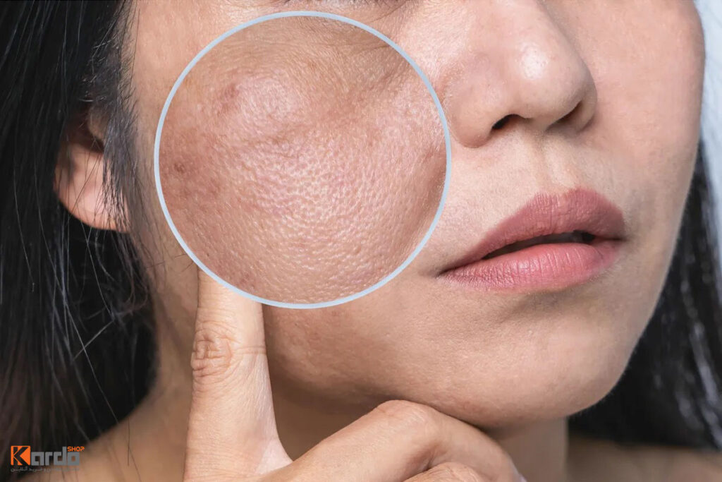 علل تیره شدن پوست صورت