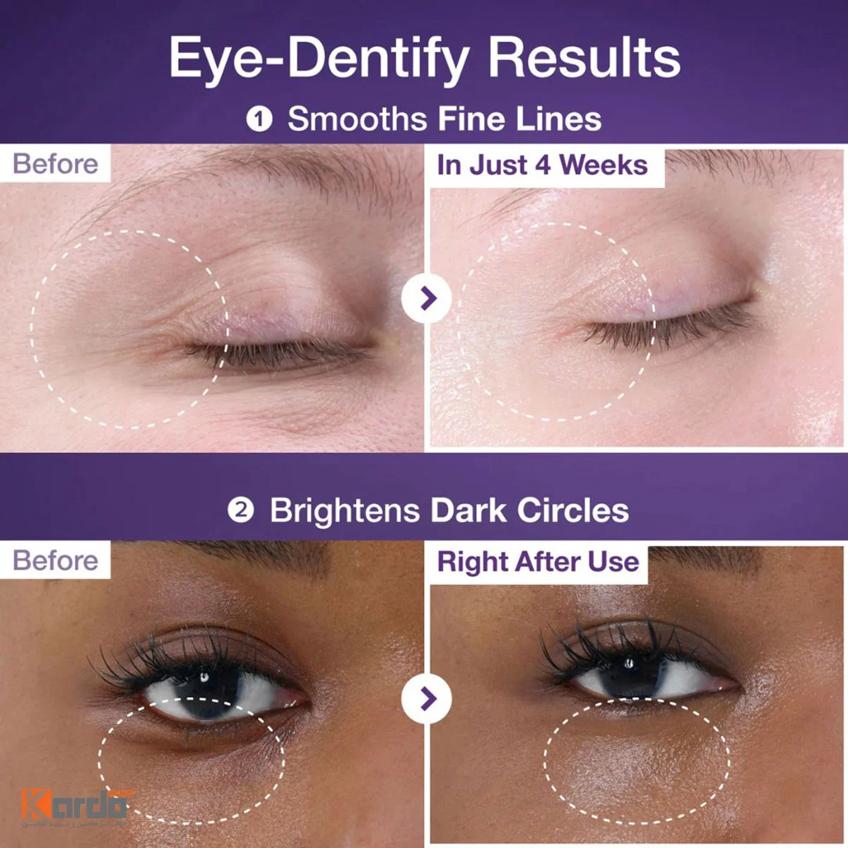 قبل و بعد از استفاده کرم دور چشم ضد چروک نامبوزین مدل No.9 NAD+ Retinol