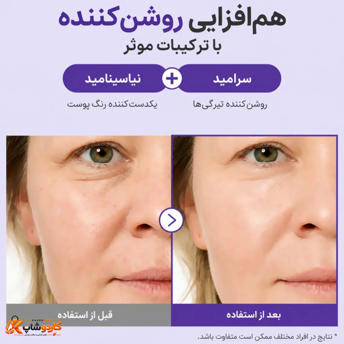 کاهش تیرگی دور چشم با استفاده از کرم دور چشم نامبوزین شماره 9 NAD+ Retinal Volumetox